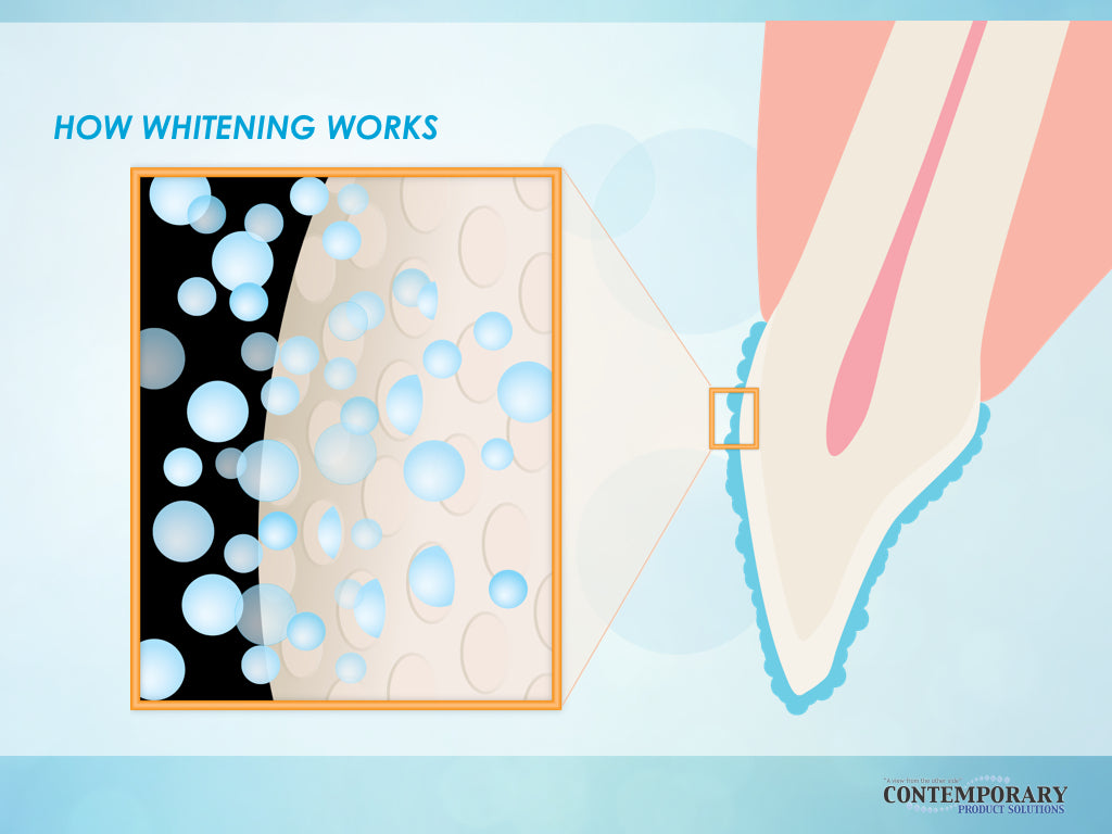 Teeth Whitening Science