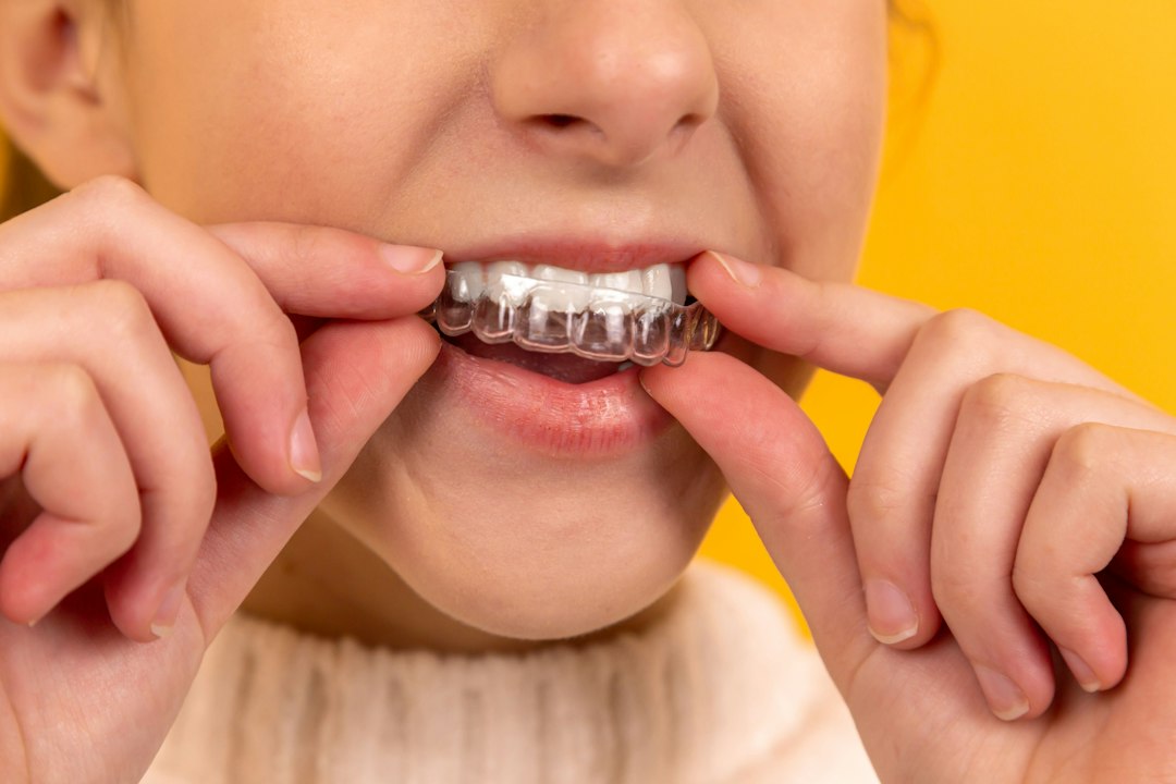 Discover Effective Home Remedies for Teeth Whitening